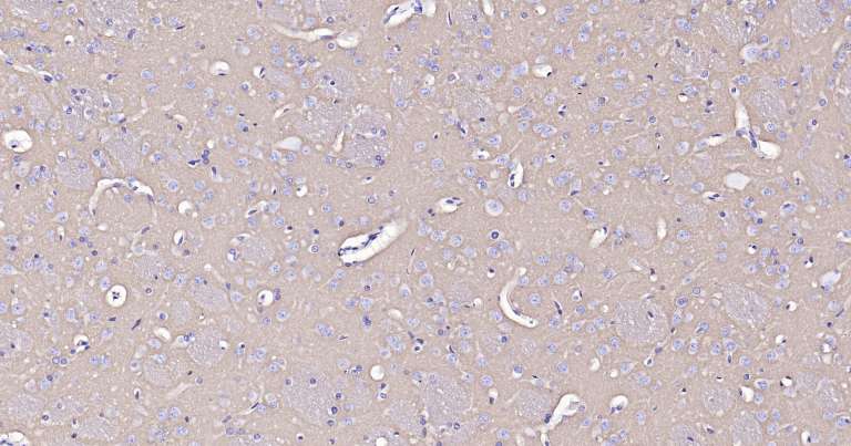 钠钾ATP酶蛋白a1即用型免疫组化试剂盒-IHC0259